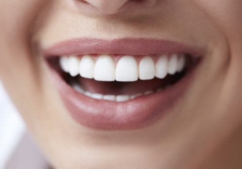What is the best way to get perfect teeth?