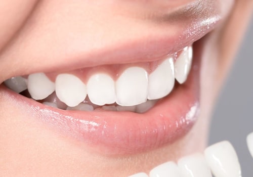 What is included in cosmetic dentistry?