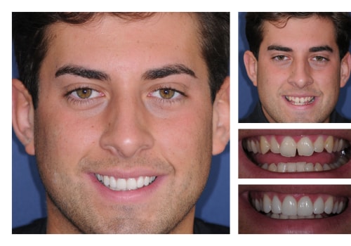 What is an example of cosmetic dentistry?